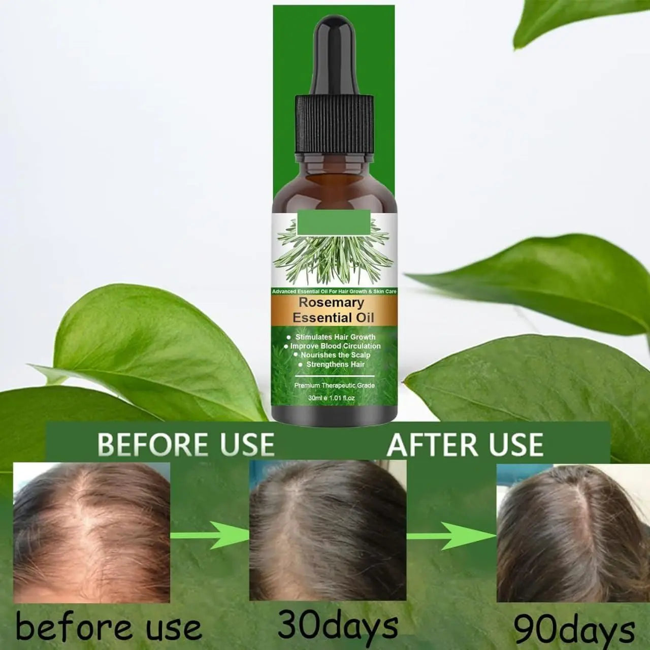 Rosemary Flourish Oil for Hair Growth 30ml SmartAura