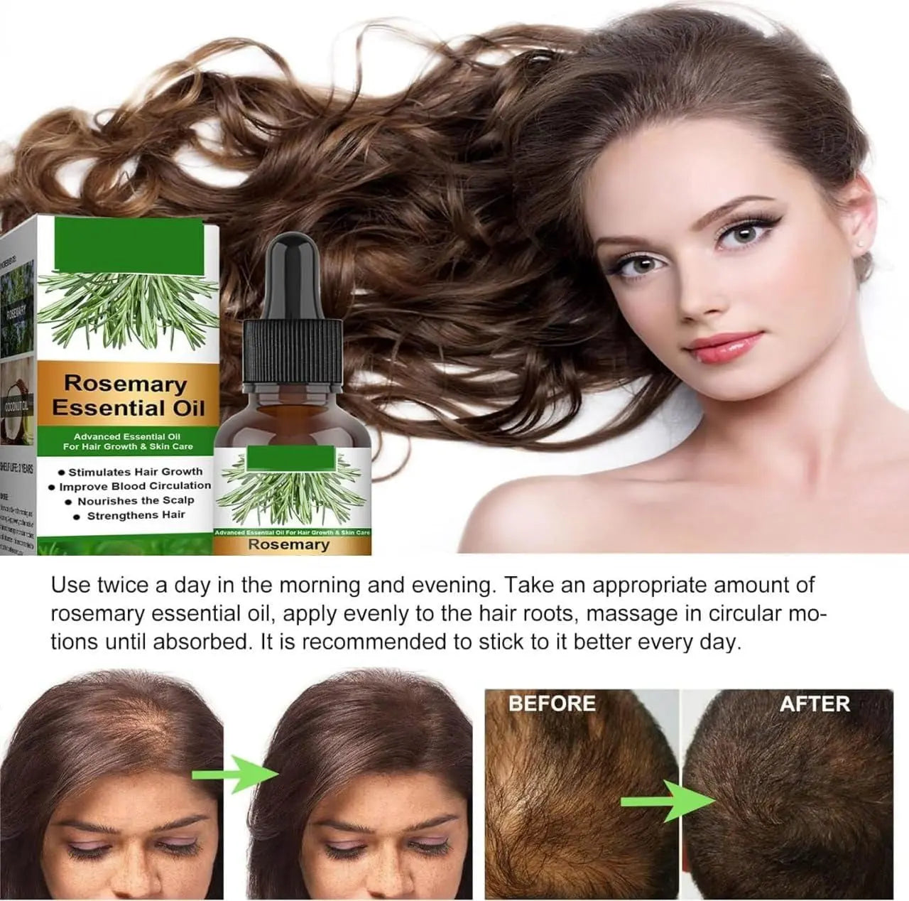 Rosemary Flourish Oil for Hair Growth 30ml SmartAura