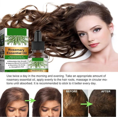 Rosemary Flourish Oil for Hair Growth 30ml SmartAura